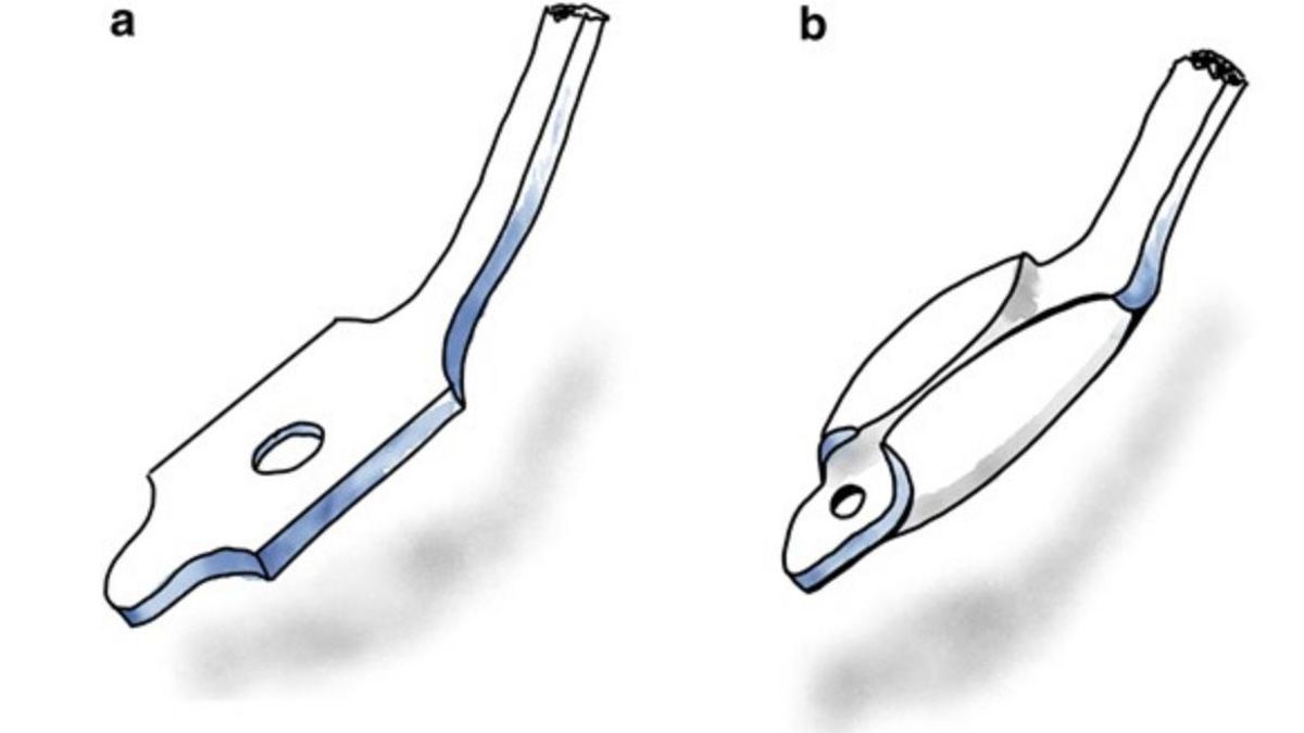 La herramienta fue hallada en una casa romana del siglo II a. C. junto a un amplio conjunto de instrumentos quirúrgicos en excelente estado de conservación