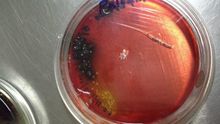 Bacteria de la Listeria.