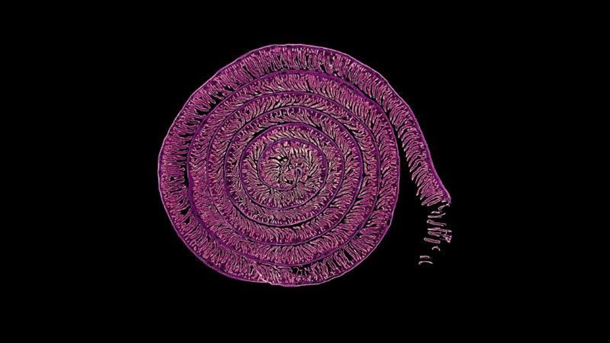 ‘Uzumaki’, la fotografía realizada en el Hospital Nacional de Parapléjicos que ha sido premiada en FOTCIENCIA21