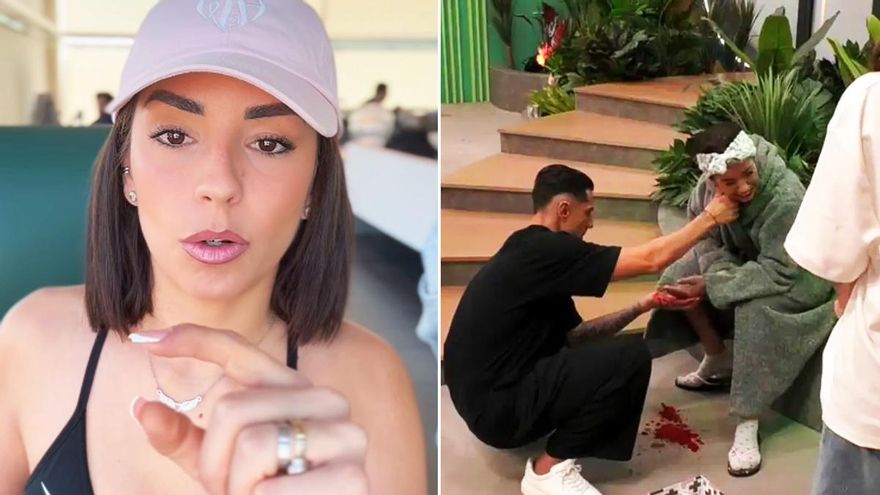Anita Williams muestra por primera vez cómo quedó su dedo tras el corte que sufrió en 'GH Dúo': "No miento"