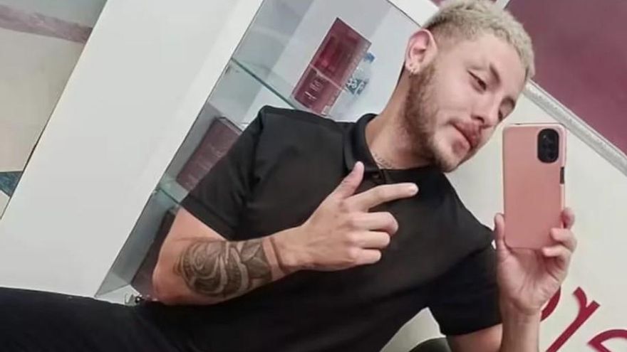 Viruela del mono: murió el joven cordobés que contrajo la enfermedad en México