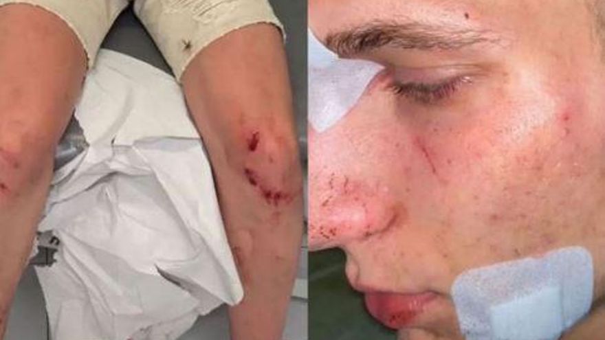 La Guardia Civil investiga una agresión grupal a un joven homosexual en Alginet