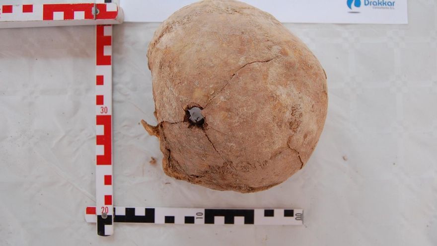 Cráneo con orificio de bala hallado en el cementerio de Alicante.