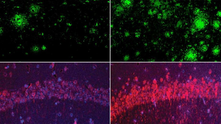 Nuevos pasos en el alzhéimer: un compuesto de litio restaura la memoria en ratones