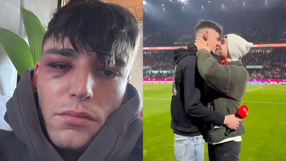 Pascal Kaiser, agredido tras proponer casamiento a su novio