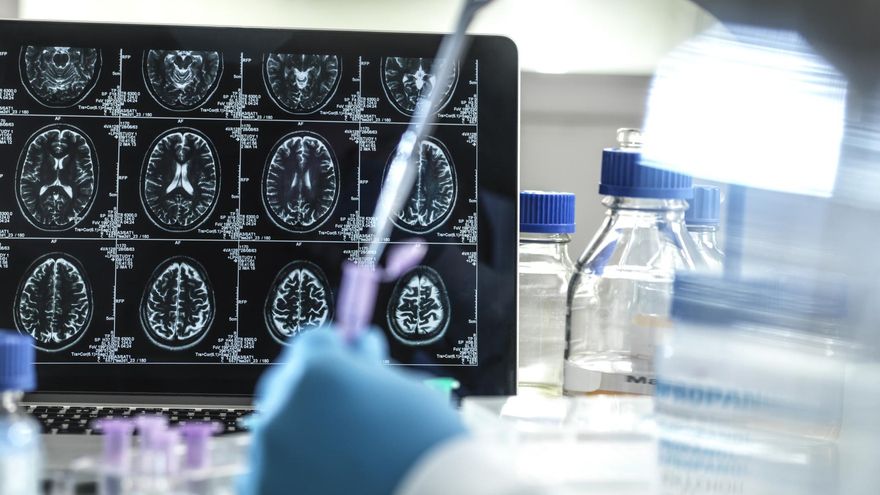 Una investigación muestra la eficacia de un tratamiento con litio frente al alzhéimer en ratones