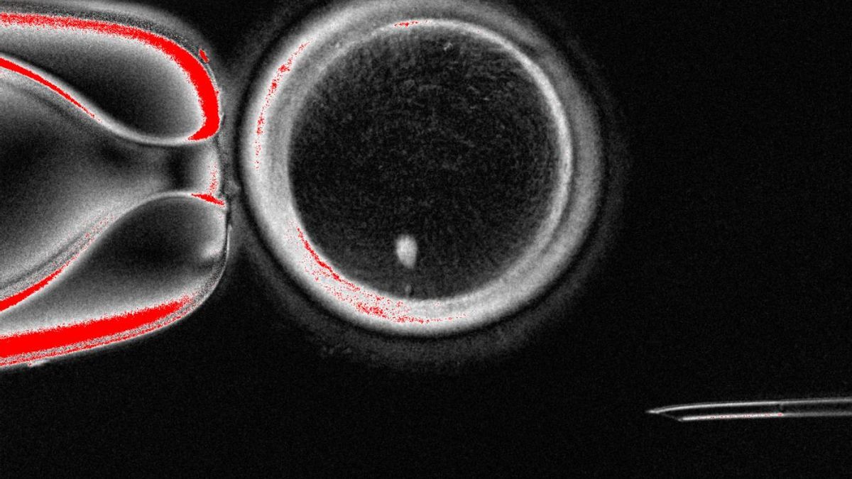 Ovocito humano SCNT con huso visible (punto brillante en el interior) antes de la fertilización.