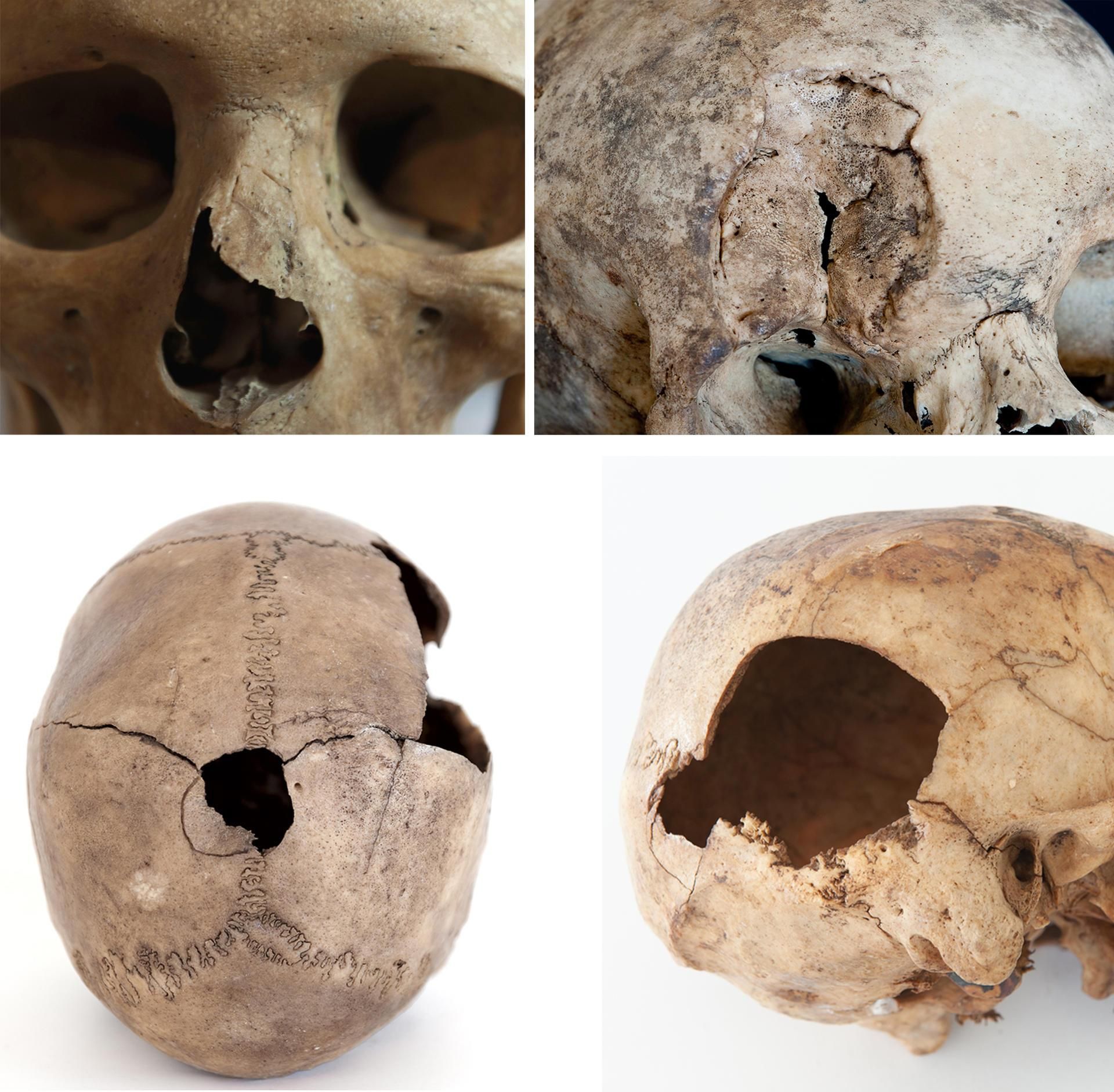 En una muestra de 1.213 cráneos de yacimientos aborígenes de la isla que abarca desde el siglo III al XV, uno de cada tres (33,8 %) presenta traumatismos violentos, como los cuatro que muestra la imagen, pertenecientes a la colección de El Museo Canario.