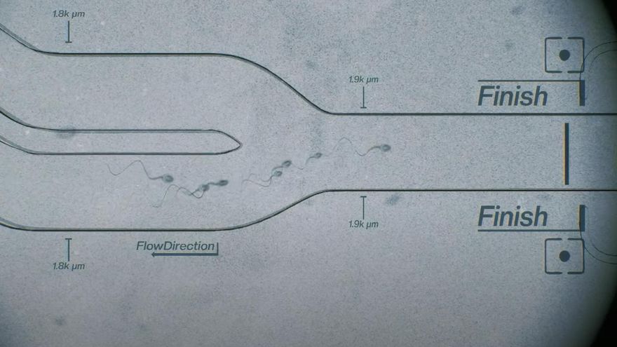 Otra de las visualizaciones de la supuesta carrera de espermatozoides.