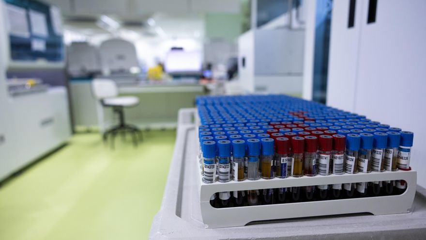 La Cronobiología o cómo saber cómo funcionan los órganos y a qué hora es mejor tratarlos