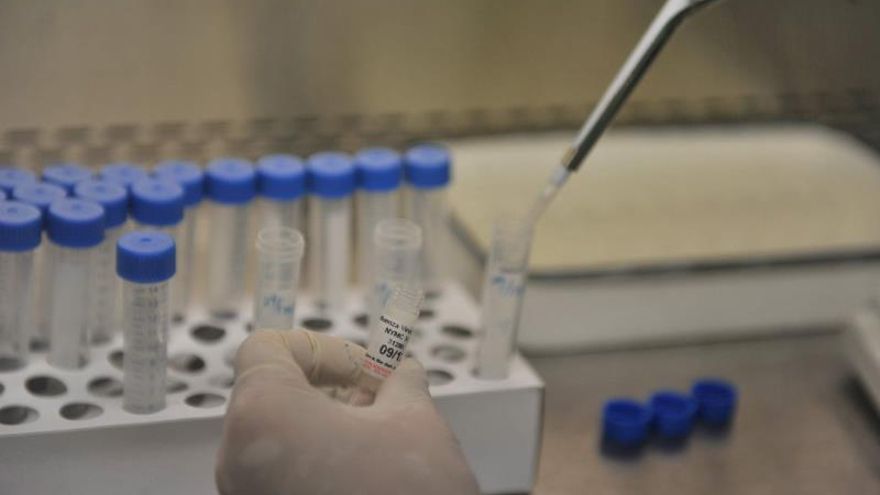 Desarrollan en Chile primer candidato vacunal del mundo contra el Hantavirus