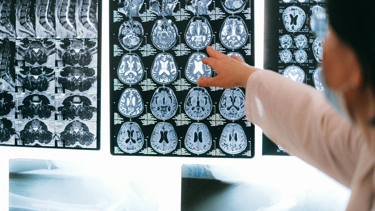 Un médico examina la neuroimagen del cerebro de un paciente.