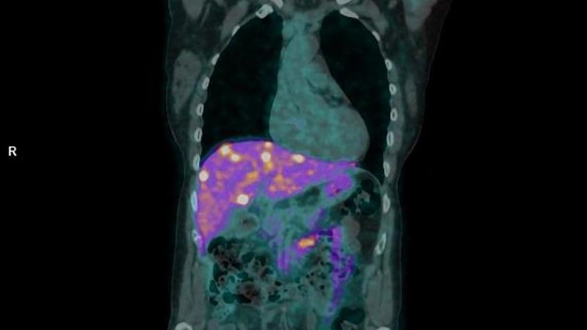 Marcador usado por el hospital.