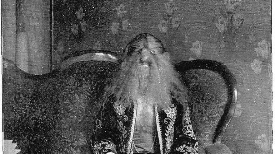 La terrible historia de Stephan Bibrowski, el hombre que acabó convertido en una "atracción de circo"