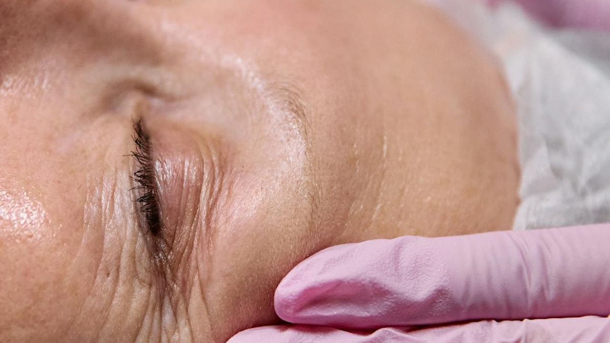 Fotoenvejecimiento: Qué efectos tiene el sol sobre el colágeno de la piel, y cómo protegerte