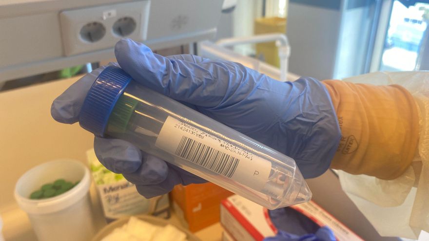 Muestras para PCR.