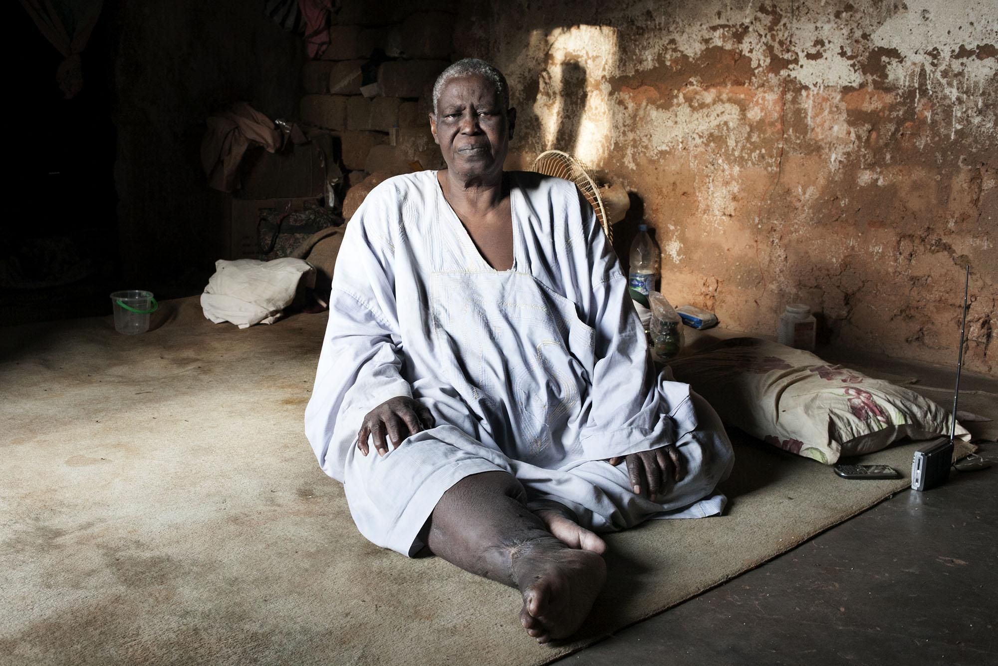 Ahmad Amad tiene 60 años y cruzó la frontera con parte de su familia en enero. Ahora vive en casa de unos familiares y desde que llegó no ha salido de su casa ya que esta gravemente enfermo y su familia no tiene los recursos económicos suficientes para llevarlo al hospital./Albert Masias