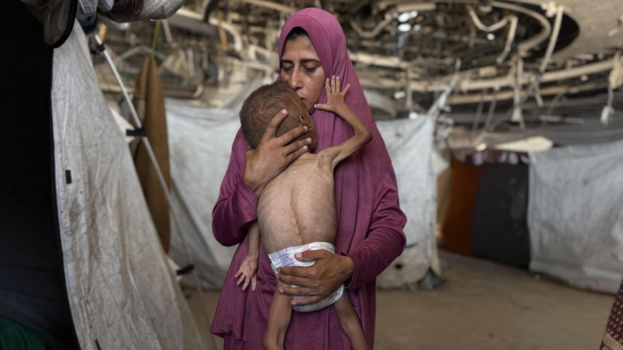 Una madre palestina sujeta a su hijo de 18 meses que sufre desnutrición por la falta de alimentos en Gaza, a finales de julio de 2025.