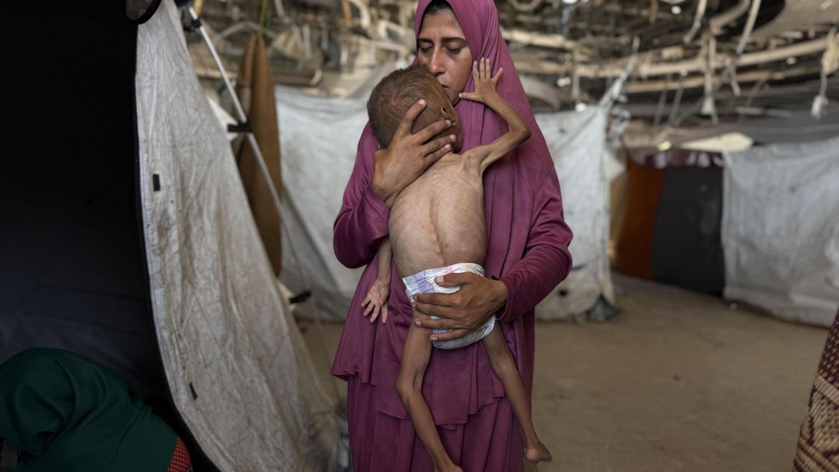 Una madre palestina sujeta a su hijo de 18 meses que sufre desnutrición por la falta de alimentos en Gaza, a finales de julio de 2025.
