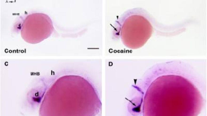Diferencias en el desarrollo de los embriones de pez cebra expuestos a cocaína (derecha) y un grupo de control. Imagen: Roger López.