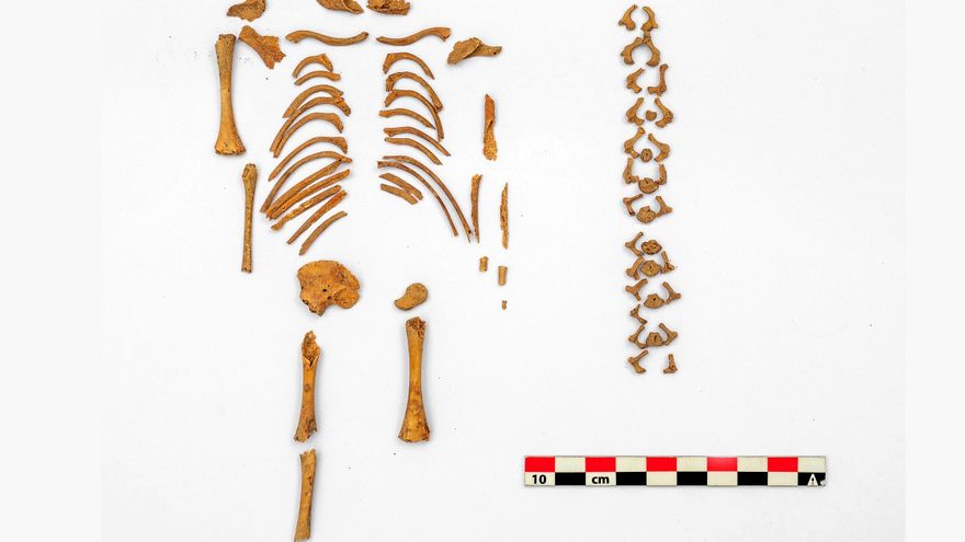 Los bebés con síndrome de Down recibían enterramientos especiales hace 5.000 años