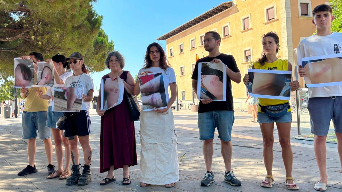 Los heridos por las cargas policiales de la protesta contra la turistificación en Balears inician acciones legales contra los agentes