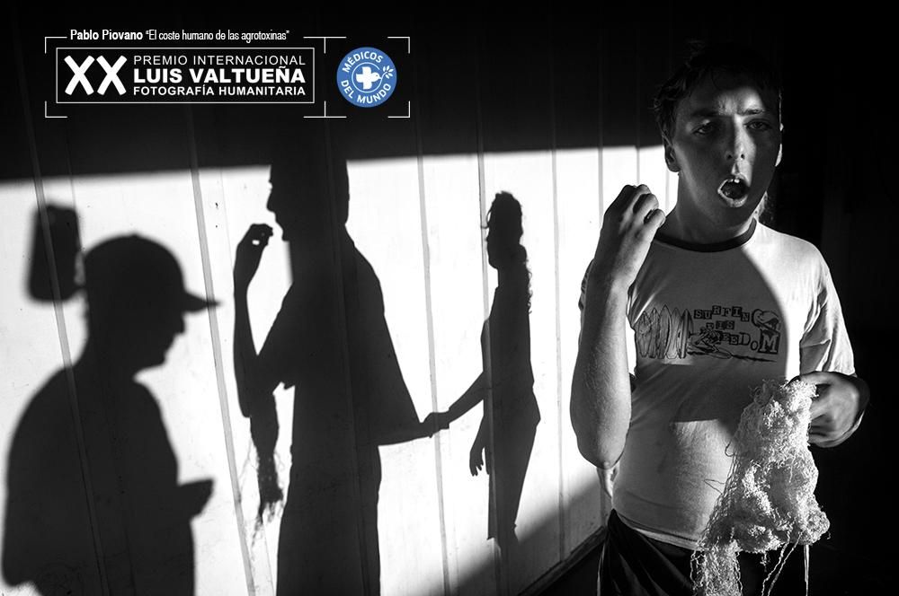 15-04-2015. Alicia Baja - Colonia Aurora, Provincia de Misiones. Andrea Gotin era una niña sana hasta que una tarde, a la edad de ocho años, inhaló bromometano y tuvo que ser hospitalizada, permaneciendo en la unidad de cuidados intensivos durante nueve días. La fiebre que tuvo unos pocos días después de inhalar la sustancia afectó la función motora de su cerebro. Necesita un trasplante de riñón y debe someterse a diálisis tres veces por semana. Su hermano Ademir, de 20 años, sufre una discapacidad psíquica severa. El 14 de septiembre 2010, el mismo día que Darío Gotin, el padre de la familia, le dijo a su esposa que su hija no podría recibir el trasplante de riñón, murió de un infarto.