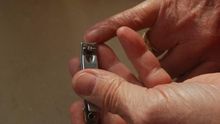¿Es malo tomar suplementos de biotina para la caída del cabello y las uñas?