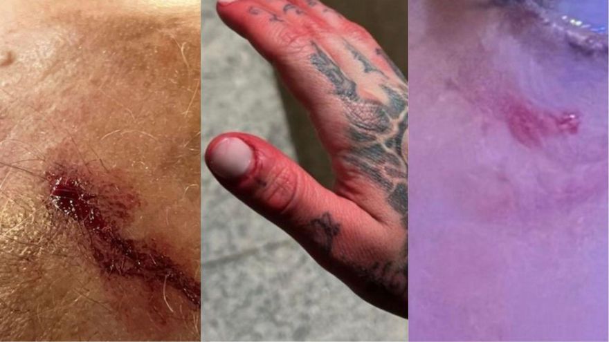 Un joven y sus padres denuncian una violenta agresión homófoba en Pacífico al grito de "maricón de mierda"