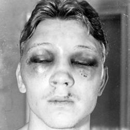 La cara de Collin Jr. quedó desfigurada