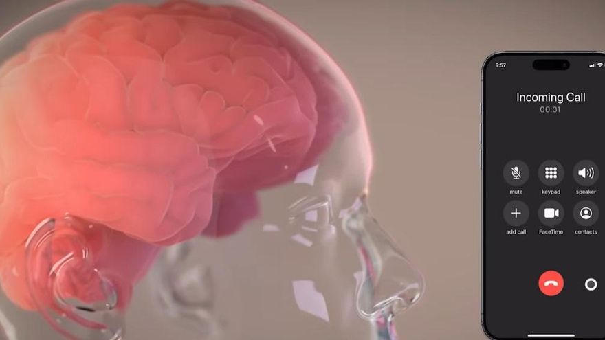 Elon Musk dice que su empresa Neuralink instaló un implante cerebral en su primer paciente humano