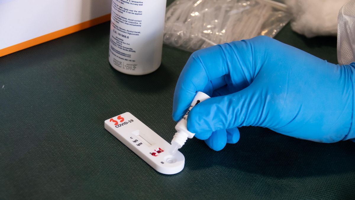 Mesa con pruebas de anticuerpos de detección del coronavirus COVID-19, foto de recurso
