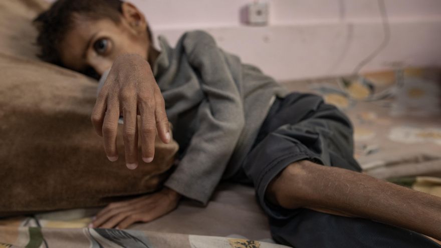 Más de 5.100 niños en Gaza, en desnutrición aguda en mayo en medio del bloqueo israelí