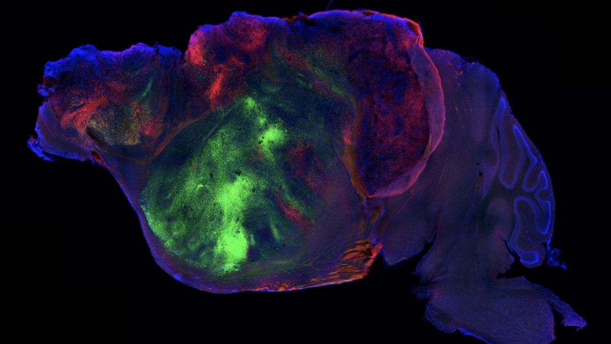 El primer ratón con una corteza cerebral ‘humana’ permitirá investigar mejor la parálisis cerebral y la demencia