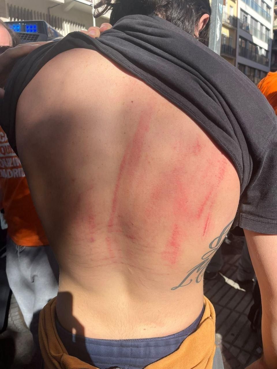 Uno de los activistas muestra golpes y rozaduras en la espalda después de ser desalojado del desahucio