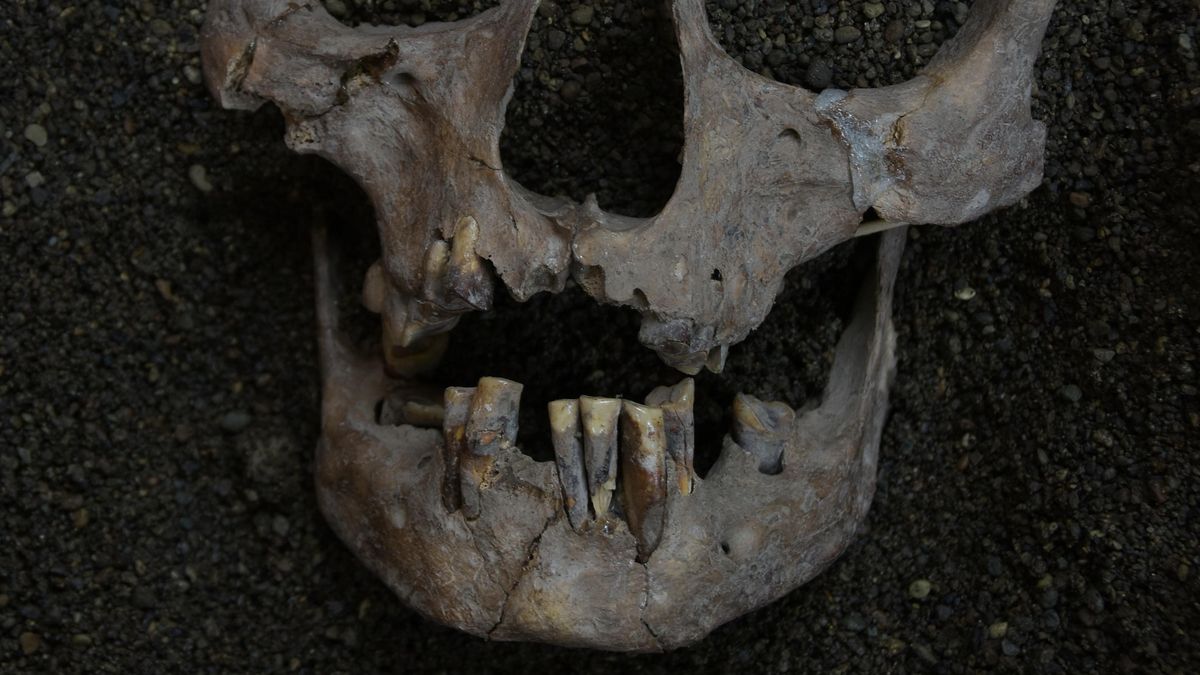 Marcas en los dientes sitúan el primer consumo de drogas de la humanidad hace 25.000 años en Indonesia