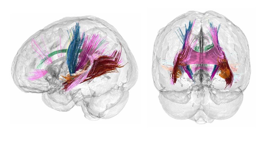 Un estudio revela los cambios que "esculpen" el cerebro de la madre durante el embarazo