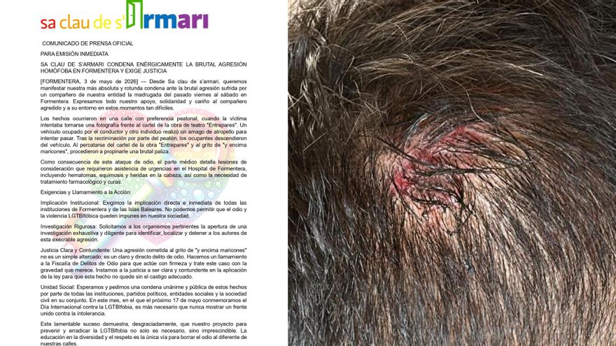 Un hombre sufre una agresión homófoba al grito de "y encima maricones" en Formentera