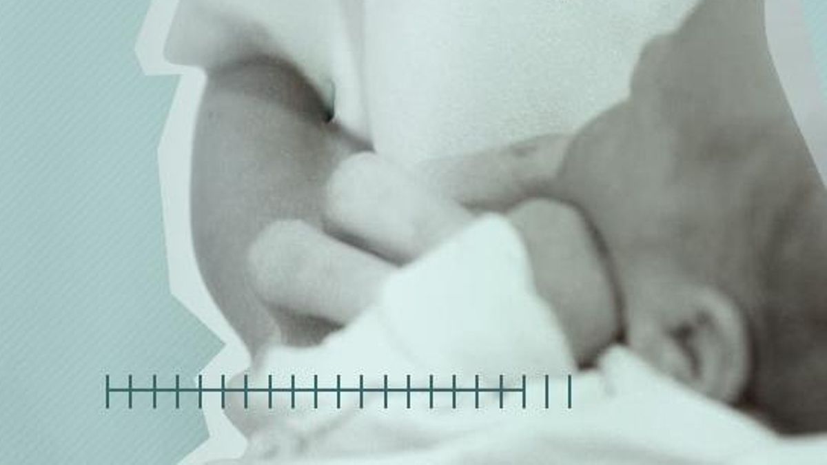 Partos con bisturí: una clínica privada de La Rioja tiene la mayor tasa de cesáreas de toda España