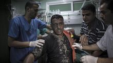 Un palestino herido por un ataque de la aviación israelí es atendido en el hospital de Kamal Adwan en la Franja de Gaza este martes / EFE