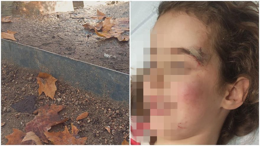 Grave accidente de una niña en el parque de Chamberí con los bordillos cortantes: siete puntos de sutura en la cabeza