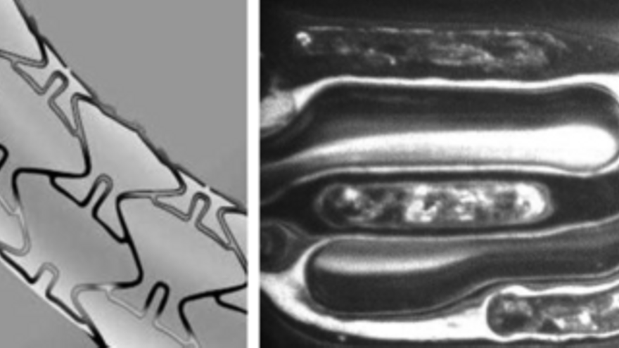 Stent Tacrolimus