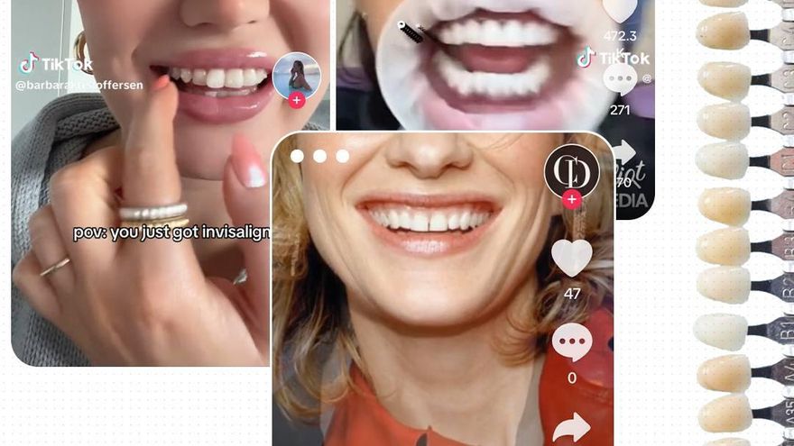 'Sonrisas Hollywood' con carillas y ortodoncias 'low cost': qué hay tras la obsesión por unos dientes hiperalineados