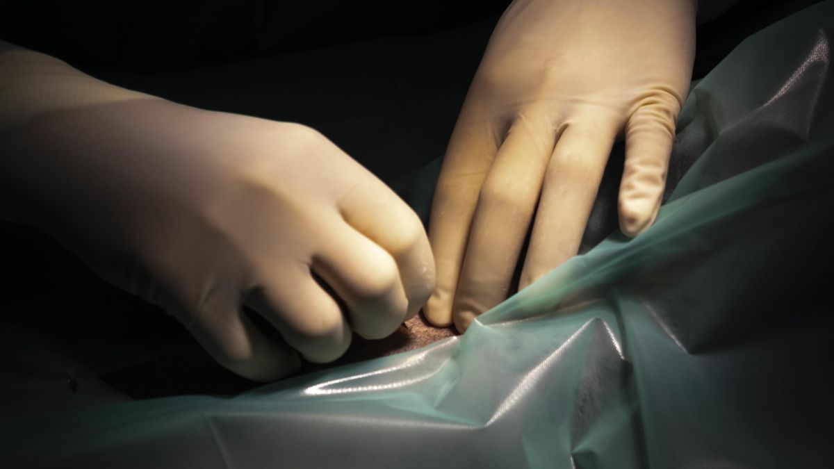 Quién paga las consecuencias de una vasectomía fallida