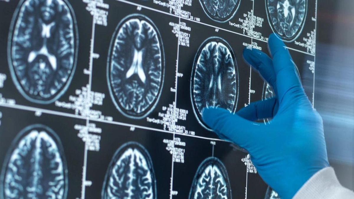 Esclerosis múltiple, la enfermedad de las mil caras