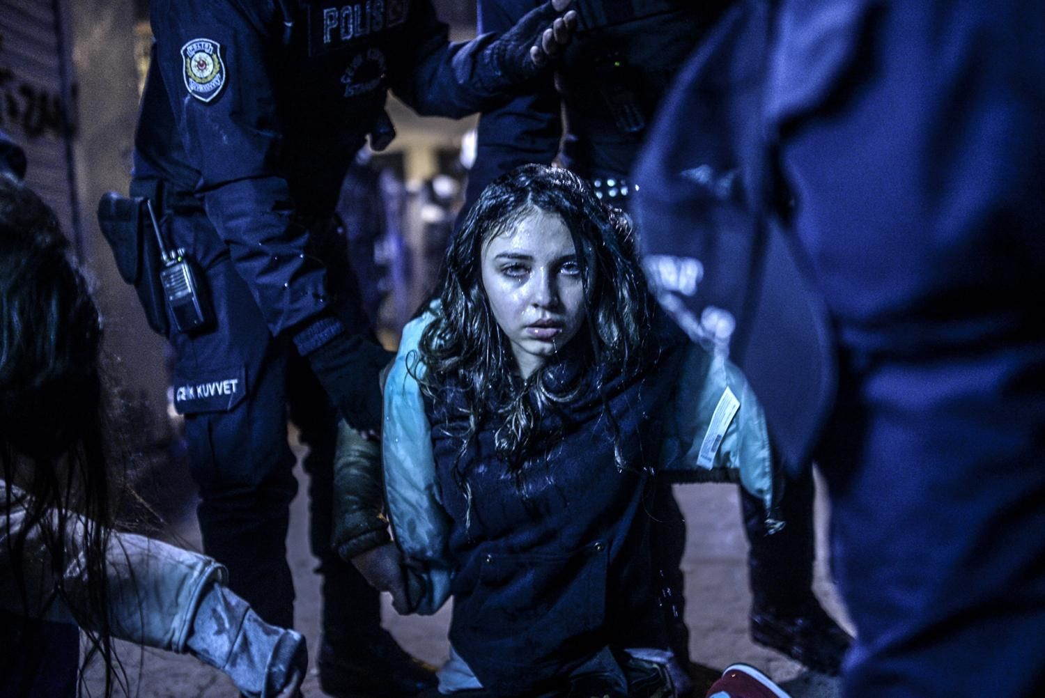 Una joven herida durante las manifestaciones de Estambul en marzo de 2014. Bulent Kilic/Premio World Press Photo