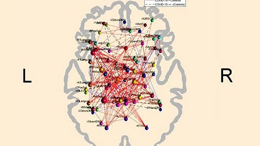 El coronavirus puede alterar patrones de conectividad cerebral. // Brunno Machado de Campos / Unicamp