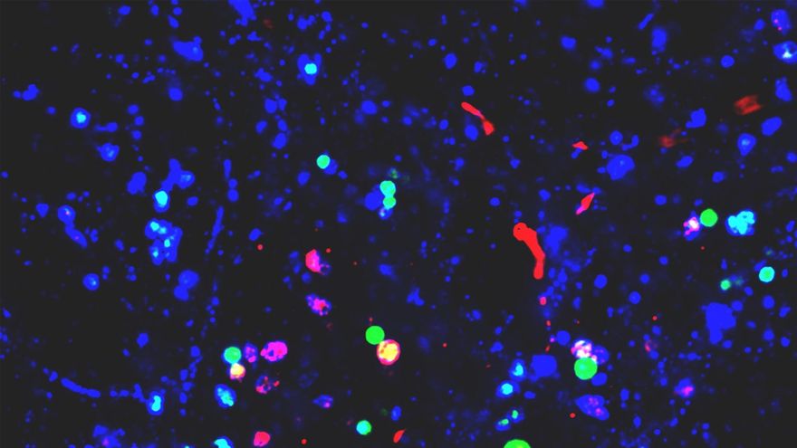 Nanopartículas: investigar lo más pequeño para lograr pasos gigantes en sanidad