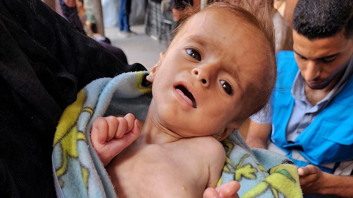 El tiempo se agota para los niños hambrientos de Gaza: ¿tomará el mundo medidas para salvarlos?