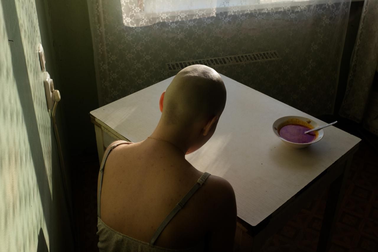 'When I Was Ill', ganadora del tercer premio en la categoría 'Retratos'. Alyona Kochetkova se sienta en casa sin ganas para comer una sopa de remolacha, su comida favorita, durante el tratamiento para el cáncer.